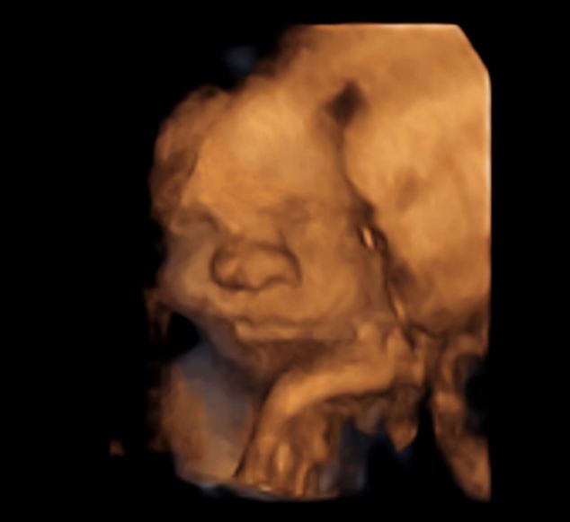 英準(zhǔn)媽媽借3D影像&ldquo;窺探&rdquo;腹中子【圖】